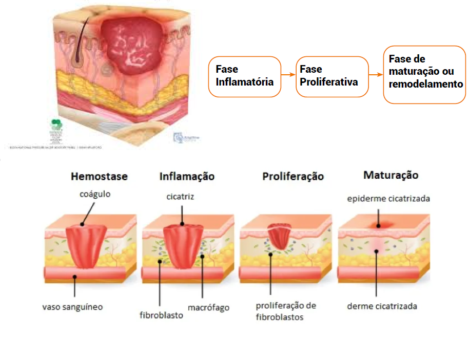 Fases da Cicatrização 