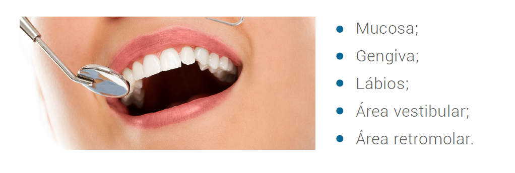 As áreas mais afetadas pelas manifestações bucais das DIIs 