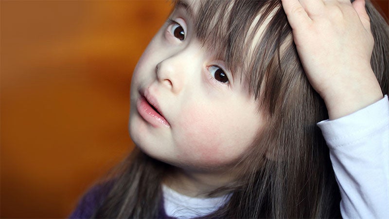 Criança com Síndrome de Down altura 2 a 20 anos menina